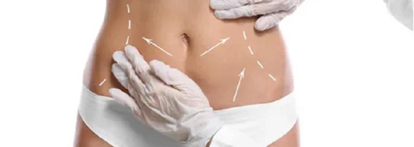Liposuction in Dubai: Expert Tips for Safe Recovery