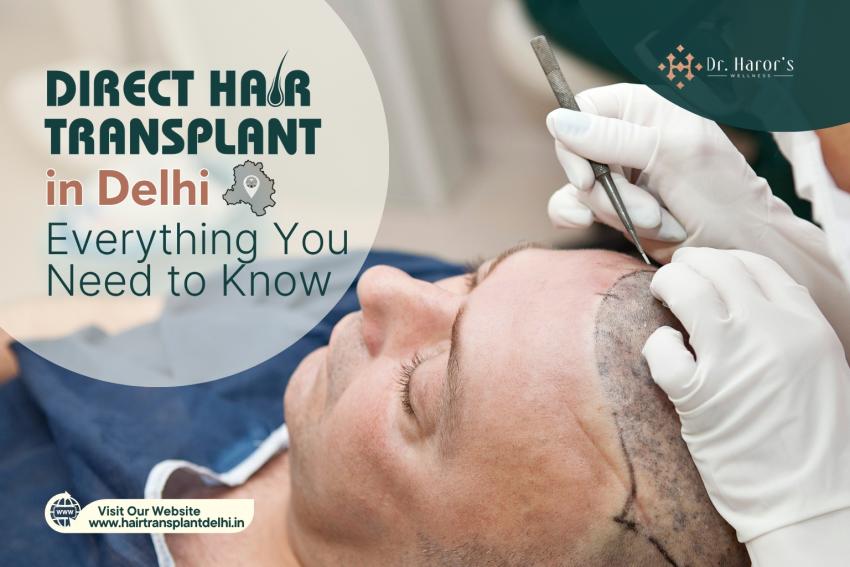 Direct Hair Transplant in Delhi: Everything You Need to Know