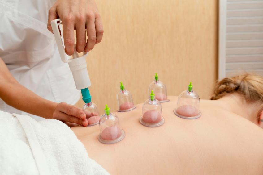 What to Expect During Your First Cupping Therapy Session in Wokingham