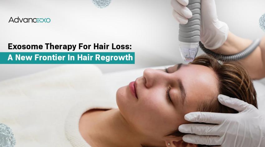 Exosome Therapy for Hair Loss: A New Frontier in Hair Regrowth