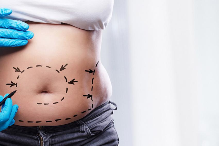 Finding Your Ideal Surgeon at Mommy Makeover Lounge