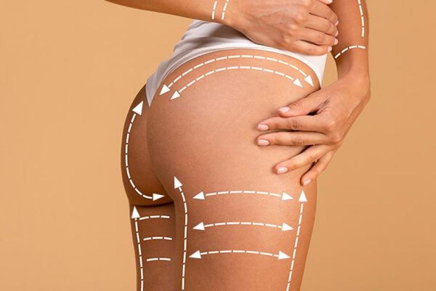 Non Surgical Butt Lift in Dubai: Smooth Results