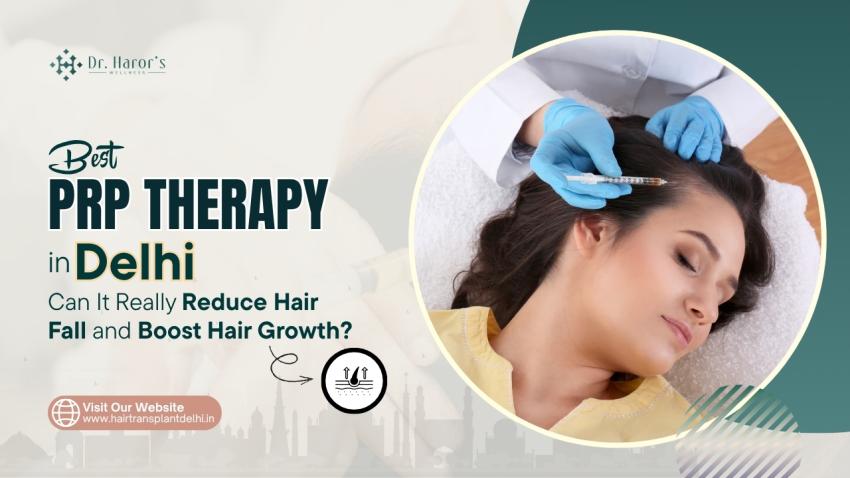 Best PRP Therapy in Delhi: Can It Really Reduce Hair Fall and Boost Hair Growth?