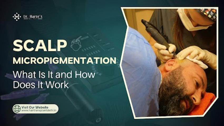 Scalp Micropigmentation: What Is It and How Does It Work?